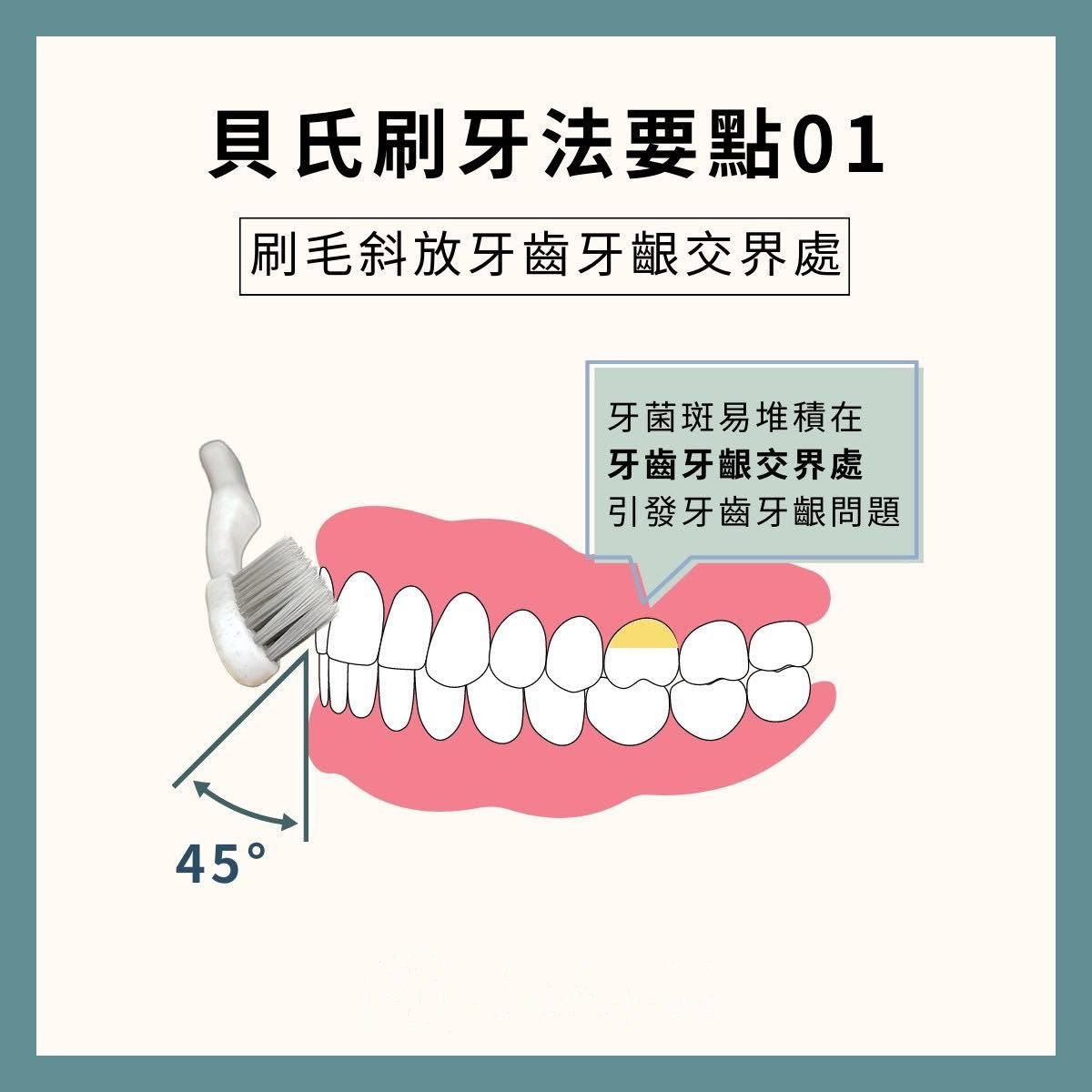 衛教圖示：貝氏刷牙法要點一，刷毛以約 45 度斜放於牙齒與牙齦交界處，清潔容易堆積牙菌斑的位置